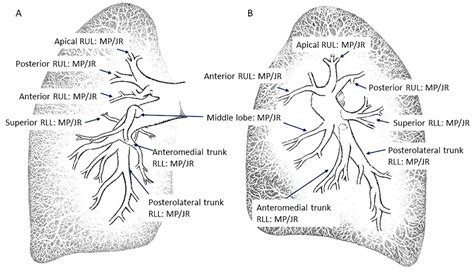 Right Pulmonary Artery Anatomy