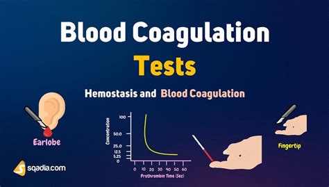 Hemostasis and Blood Coagulation - Blood Coagulation Tests