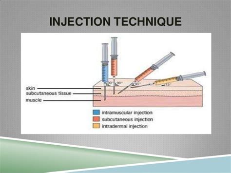 Injection Technique