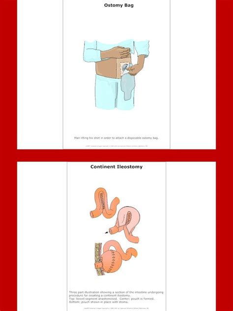 GastroIntestinal Charts and Diagrams with Private Label Rights. 46 ...