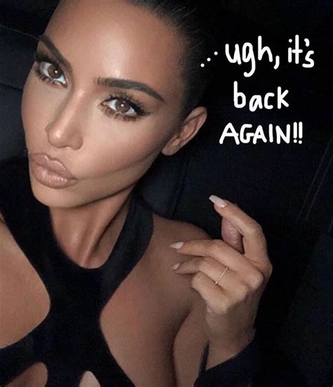 Kim Kardashian Shares Another Look At Her 'Psoriasis Face' As Her ...