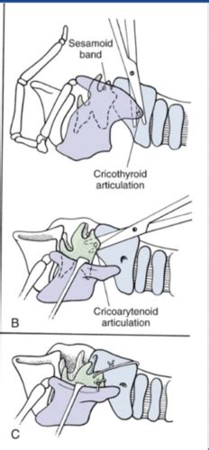 11-Laryngeal Paralysis Flashcards | Quizlet