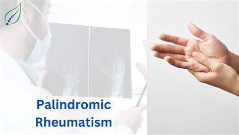 Palindromic Rheumatism: Symptoms, Causes & Management | Best Back Pain, Slip Disc, Knee ...