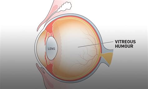 The vitreous humour: Function, related conditions & more