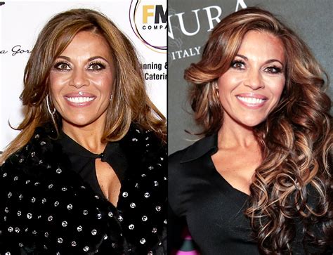 How RHONJ’s Dolores Catania Fixed Her Botched Breast Surgery