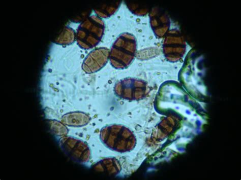 Sustainable Mycology: Pithomyces spp.