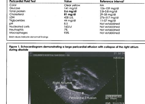 Pericardial fluid analysis | Download Table