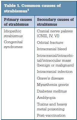 Screening for Strabismus | Squint Examination - Utsav Eye Clinic