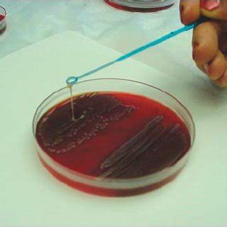 Mucoid phenotype of Klebsiella pneumoniae. When colonies were touched... | Download Scientific ...