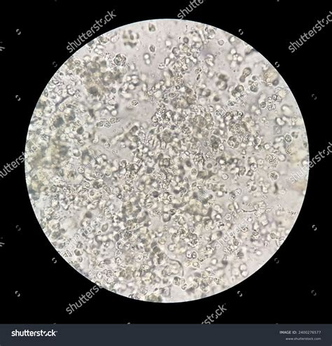 Sputum Smear Without Stain Under Microscopy Stock Photo 2400276577 ...