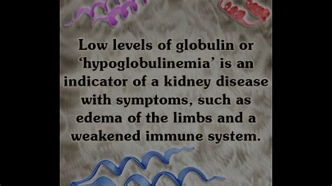 Important Information About Low Globulin All Must Be Aware Of - YouTube