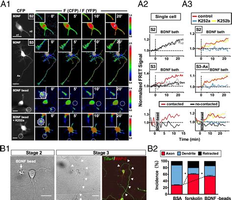 axon development | Semantic Scholar