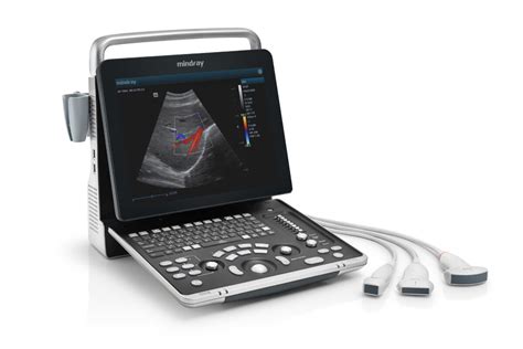 Mindray – The Ultrasound Source