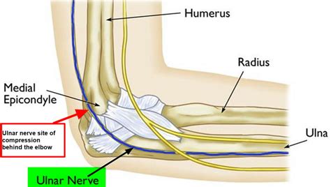 Ulnar neuropathy causes, symptoms, diagnosis, treatment & exercises