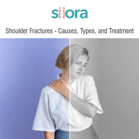 Shoulder Fractures - Causes, Types, and Treatment - Siora Surgicals Private Limited