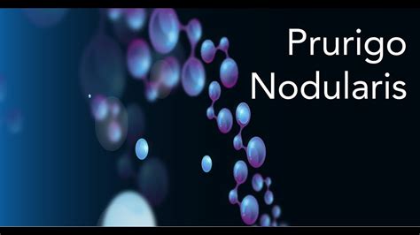 Natural Remedies For Prurigo Nodularis - Top 15 Treatments