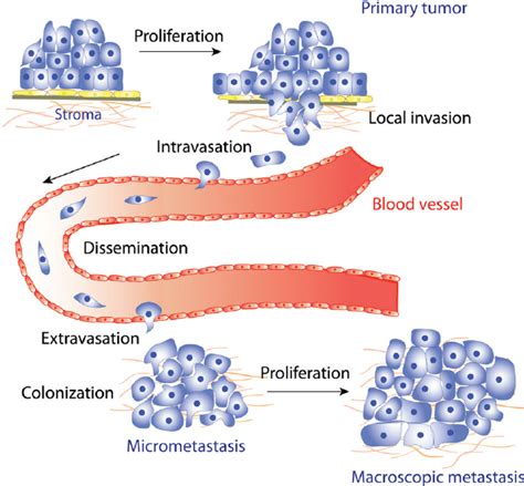 Metastasis Diagram