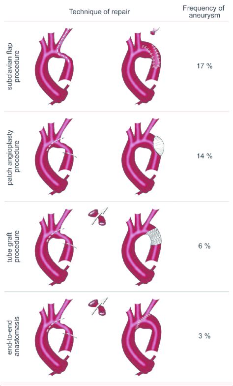 Various techniques for surgical repair of aortic coarctation ...