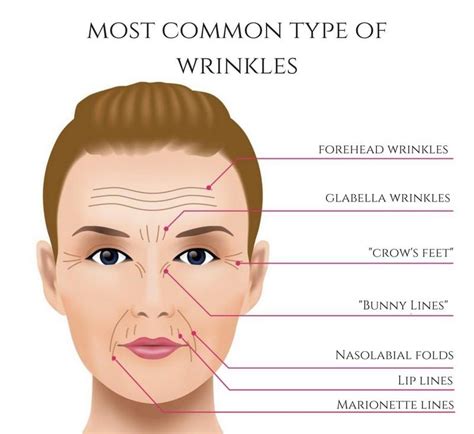 Wrinkles | Wrinkles, How to line lips, Forehead wrinkles