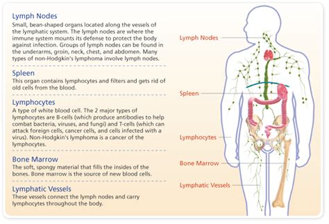 Non Hodgkings Lymphoma (B-Cell related) | Hodgkins lymphoma, Lymphoma, Non hodgkins lymphoma