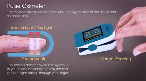 Pulse Oximetry: Mechanism, History, Use and Sources of error