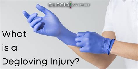 Degloving Injury Management