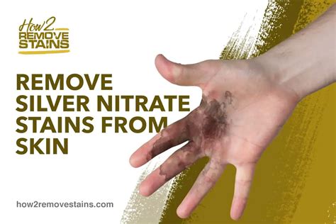 How to Remove Silver Nitrate Stains from Skin [ Detailed Answer ]