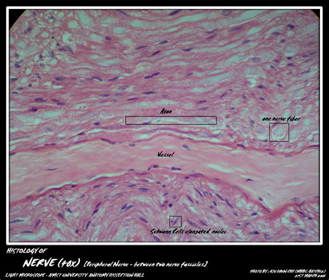 Histology: Nerve Fibers | My Aimst University Lifestyle Blog