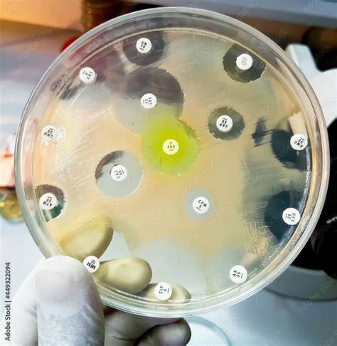 Antimicrobial susceptibility testing in petri dish. Antibiotic resistance of bacteria Stock ...