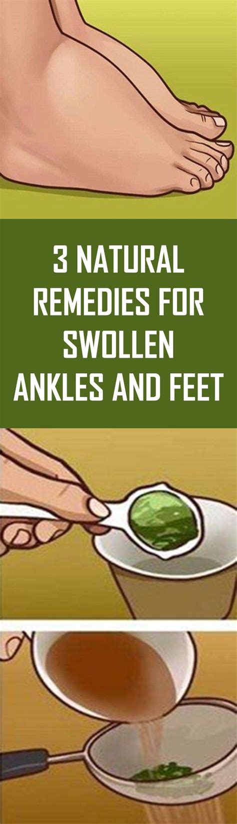 3 Natural Remedies For Swollen Ankles and Feet, #body #Care #feetcare # ...