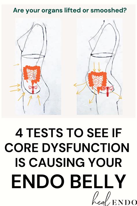 Endo Belly? See if you have core dysfunction | Lower belly pooch, Belly pooch, Exercise for ...