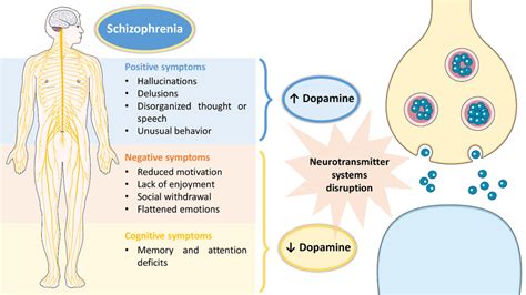 Pathophysiology of schizophrenia, including associated symptoms and ...