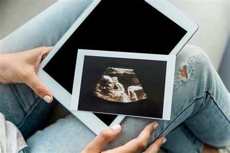 What Are 3D Sonograms – Why You Need to Get A 3D Sonogram - 4Baby Ultrasound & Photography boutique