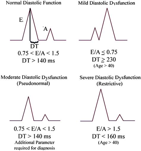 Diastolic Heart Failure: A Review and Primary Care Perspective | American Board of Family Medicine