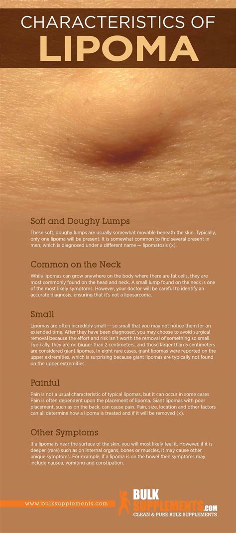 Tablo | Read 'Lipoma: Characteristics, Causes & Treatment' by