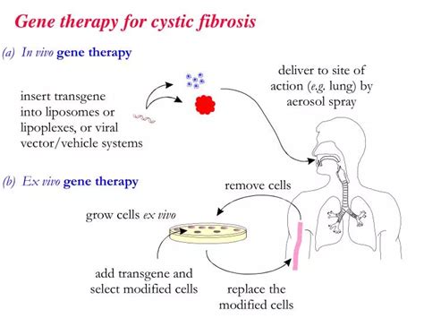 PPT - Gene therapy for cystic fibrosis PowerPoint Presentation - ID:1814373