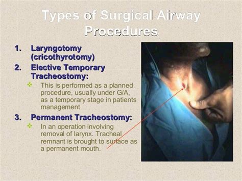 Surgical airway procedures