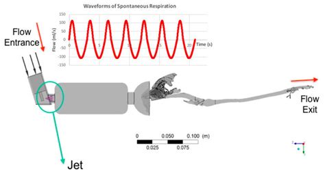 Pressurized metered-dose inhaler (pMDI) connected to a 10 cm spacer and... | Download Scientific ...