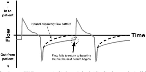 Figure 9 from Ventilator waveforms. | Semantic Scholar