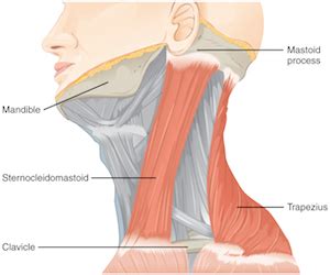 Radical Neck Dissection: Definition, Complications & Side Effects | Study.com