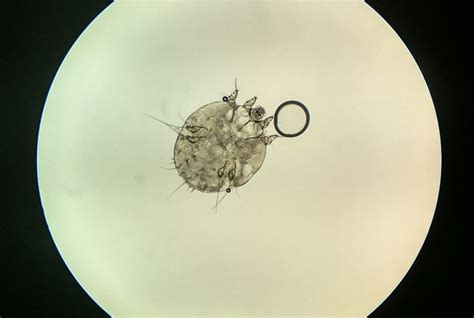 Scabies Mite Under Microscope