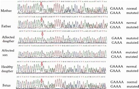 | Partial ATM gene sequences determined by Sanger sequencing (upper ...