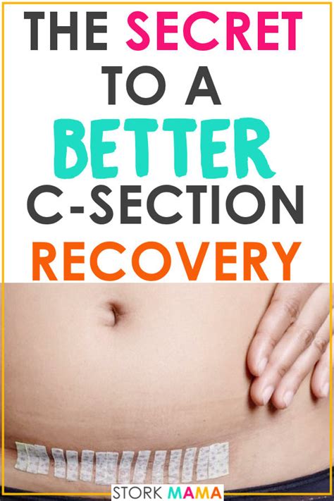 C-Section Scar Healing Care Guide ( )- Stork Mama