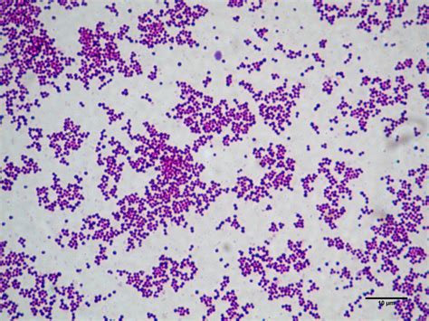 Chapter 1 Genus Staphylococci : Identification ,Diagnosis and Treatment