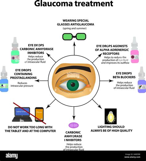 Glaucoma treatment. Eye drops. World glaucoma day. The anatomical structure of the eye ...