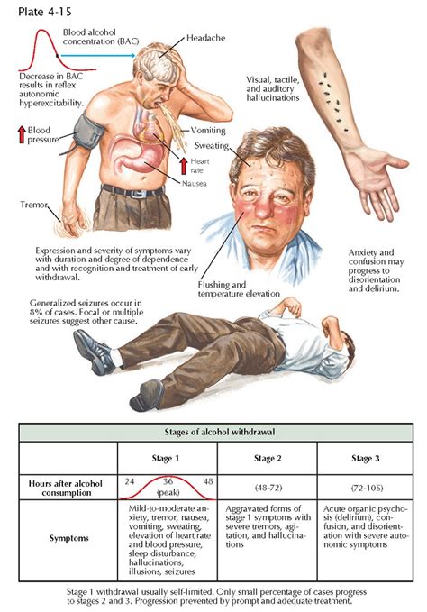 Alcohol Withdrawal - pediagenosis