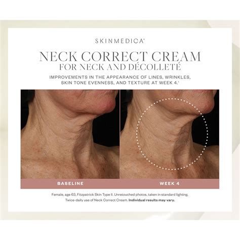 SkinMedica Neck Correct Cream - EDCskincare.com