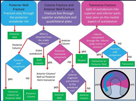 Judet and Letournel classification for acetabular fractures – Radiology ...