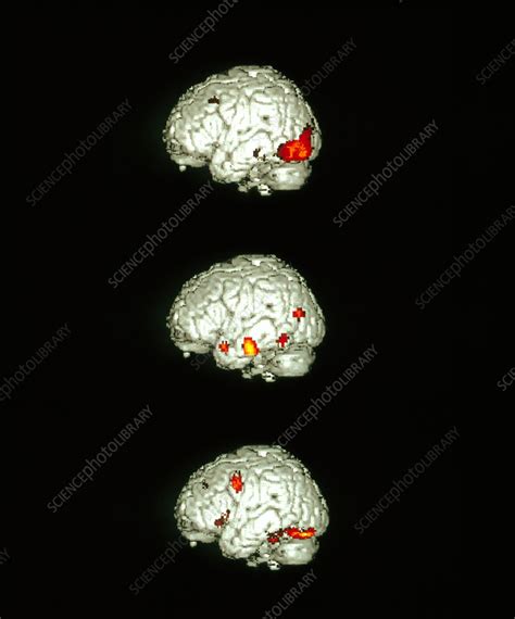 Image-processing brain activity - Stock Image - P335/0060 - Science Photo Library