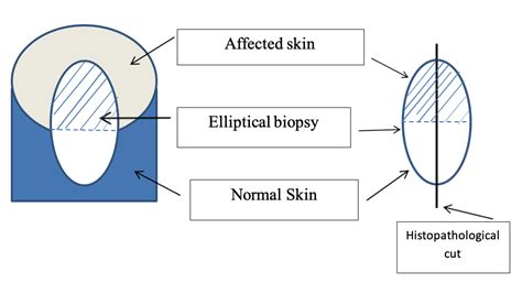 Skin Punch Biopsy: An overview for the Veterinary Nurse